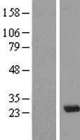 MAD3 (MXD3) Human Over-expression Lysates NM_031300