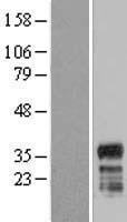 FAM110A Human Over-expression Lysates NM_207121