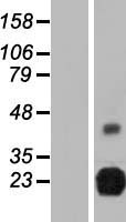 ls083546 rtbdn human over expression lysates nm 001080997 wb testing 1
