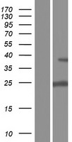 UCK (UCK1) Human Over-expression Lysates NM_001135954
