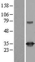 UCK (UCK1) Human Over-expression Lysates NM_031432