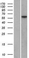 MFRP Human Over-expression Lysates NM_031433