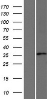 AKR1CL2 (AKR1E2) Human Over-expression Lysates NM_001040177