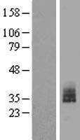 BCL2L12 Human Over-expression Lysates NM_001040668