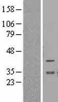 BCL2L12 Human Over-expression Lysates NM_138639