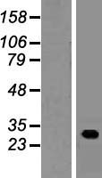 C22orf13 (GUCD1) Human Over-expression Lysates NM_031444