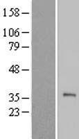 ls083639 tex101 human over expression lysates nm 031451 wb testing 1