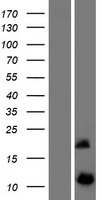 ls083657 dynlrb2 human over expression lysates nm 130897 wb testing 1