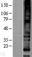 ls083661 ms4a8b ms4a8 human over expression lysates nm 031457 wb testing 1