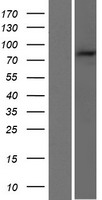 PARP9 Human Over-expression Lysates NM_001146106