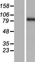 PARP9 Human Over-expression Lysates NM_031458