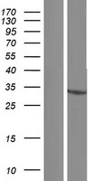 HSDL1 Human Over-expression Lysates NM_001146051