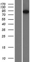 Espin (ESPN) Human Over-expression Lysates NM_031475
