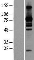 L3MBTL2 Human Over-expression Lysates NM_031488
