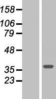 SVH (ARMC10) Human Over-expression Lysates NM_031905
