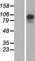 USP26 Human Over-expression Lysates NM_031907