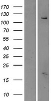 ls083850 fam62c esyt3 human over expression lysates nm 031913 wb testing 1