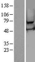 RSPH3 Human Over-expression Lysates NM_031924