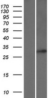 ls083871 rab34 human over expression lysates nm 001142625 wb testing 2