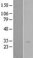 ls083871 rab34 human over expression lysates nm 031934 wb testing 1