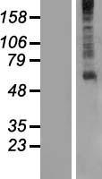 GPR61 Human Over-expression Lysates NM_031936