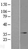 ls083876 mro human over expression lysates nm 031939 wb testing 1