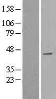 CDCA7 Human Over-expression Lysates NM_145810