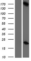 Haspin (GSG2) Human Over-expression Lysates NM_031965