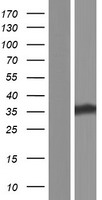 CDA11 (TATDN1) Human Over-expression Lysates NM_001146160
