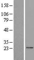 TM2D1 Human Over-expression Lysates NM_032027
