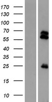 TMPRSS13 Human Over-expression Lysates NM_001077263