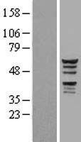 ls084056 katnal1 human over expression lysates nm 032116 wb testing 1