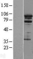 PRAM1 Human Over-expression Lysates NM_032152
