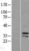 ZIC4 Human Over-expression Lysates NM_032153