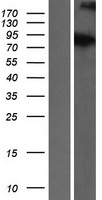 ATRIP Human Over-expression Lysates NM_130384
