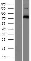 CEP78 Human Over-expression Lysates NM_032171