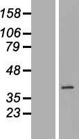 BXDC1 (RPF2) Human Over-expression Lysates NM_032194