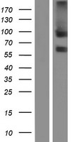 ls084168 tem8 antxr1 human over expression lysates nm 018153 wb testing 2