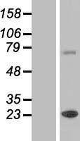 ZCCHC7 Human Over-expression Lysates NM_032226