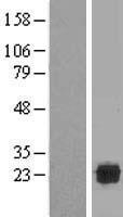 C21ORF56 (SPATC1L) Human Over-expression Lysates NM_032261