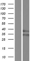 RHBDD1 Human Over-expression Lysates NM_001167608