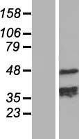 TCHP Human Over-expression Lysates NM_032300