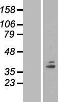 COQ5 Human Over-expression Lysates NM_032314