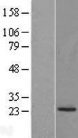 PRADC1 Human Over-expression Lysates NM_032319