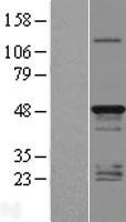 TMEM79 Human Over-expression Lysates NM_032323