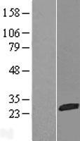 C1orf57 (NTPCR) Human Over-expression Lysates NM_032324