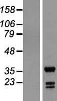 ING5 Human Over-expression Lysates NM_032329