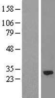 Calpain S2 (CAPNS2) Human Over-expression Lysates NM_032330