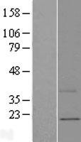 MNF1 (UQCC2) Human Over-expression Lysates NM_032340