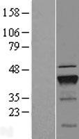 MGC13096 (PDCD2L) Human Over-expression Lysates NM_032346